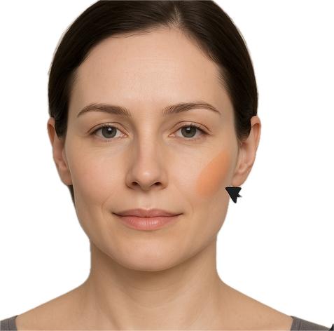 Wangenmodellierung